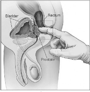 The Male G-Spot